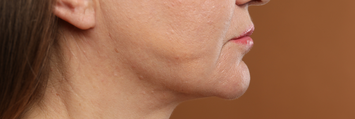Zoom sur la peau du visage d'une femme âgée
