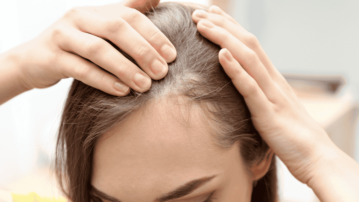 chute de cheveux remède naturel